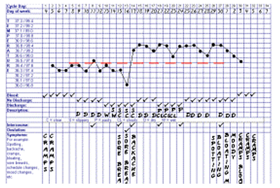 BBT Chart